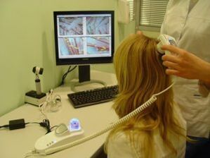 Diagnóstico de psoriasis en el cuero cabelludo.